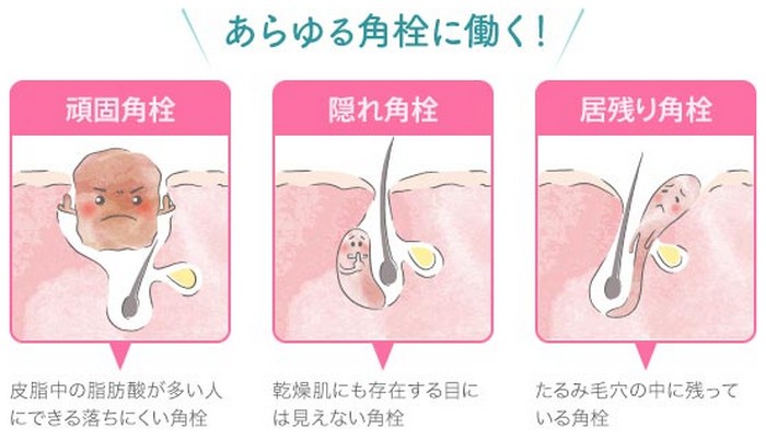 あらゆる角栓に効く